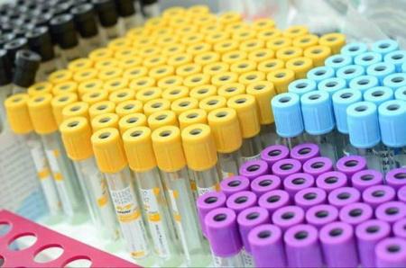 Пробирки вакуумные для исследования сыворотки c активатором свертывания и гелем,16х100 мм, 8,5 мл, пластик, 100 шт/уп