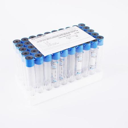 Пробирки вакуумные с цитратом натрия 3,8%, 8,1 мл, 16х100 мм, пластик, 50 шт/упак, для коагулологических исследований, Lind-Vac