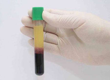 Пробирки вакуумные с литий гепарином и гелем, 6 мл, 13х100 мм, 100 шт, пластик, для исследования плазмы