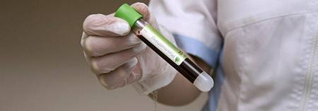 Пробирки вакуумные с литий гепарином и гелем, 6 мл, 13х100 мм, 100 шт, пластик, для исследования плазмы