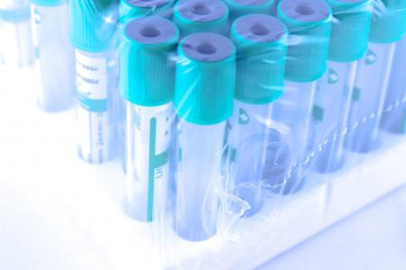 Пробирки вакуумные с литий гепарином 4 мл, 13х75 мм, 100 шт, пластик, для исследования плазмы, MMed Пробирки вакуумные с литий гепарином 4 мл, 13х75 мм, 100 шт, пластик, для исследования плазмы, MMed