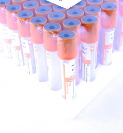 Пробирка вакуумная с активатором свертывания 4 мл, 13х75 ММ, 100 шт/упак, пластик, для исследования сыворотки M.MED