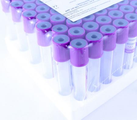 Пробирки с ЭДТА К2, 5 мл, 13х75 мм, пластик, для гематологических исследований, 100 шт/упак