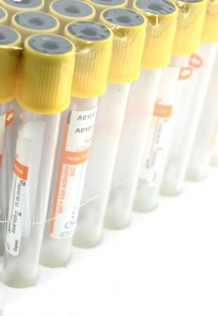 Пробирки вакуумные для исследования сыворотки c активатором свертывания и гелем, 13х100 мм, 5 мл, пластик, M.MED, 100 шт/упак Пробирки вакуумные для исследования сыворотки c активатором свертывания и гелем, 13х100 мм, 5 мл, пластик, M.MED, 100 шт/упак