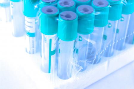 Пробирки вакуумные для плазмы, натрий гепарин,13х75 мм, 3 мл, пластик, упаковка 100 шт