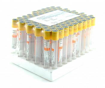 Пробирки вакуумные c активатором свертывания и гелем, 13х100 мм, 6 мл, пластик, для исследования сыворотки, упаковка 100 шт Пробирки вакуумные c активатором свертывания и гелем, 13х100 мм, 6 мл, пластик, для исследования сыворотки, упаковка 100 шт