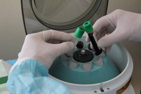 Пробирки вакуумные с литий гепарином и гелем, 6 мл, 13х100 мм, 100 шт, пластик, для исследования плазмы