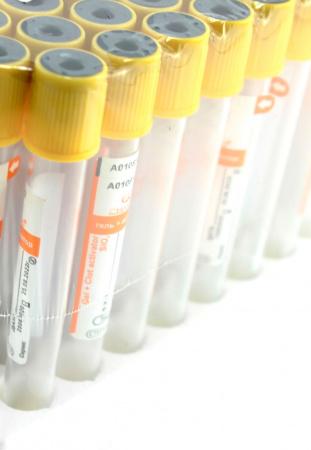 Пробирки вакуумные 13х75 мм, 4 мл, пластик, для сыворотки с гелем, упаковка 100 шт